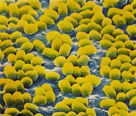 damaged bacterial spores